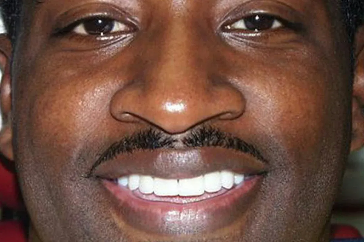 Steve, after treatment at The Smile Center.