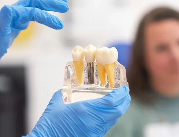 Dental Implants at The Smile Center in Virginia Beach.